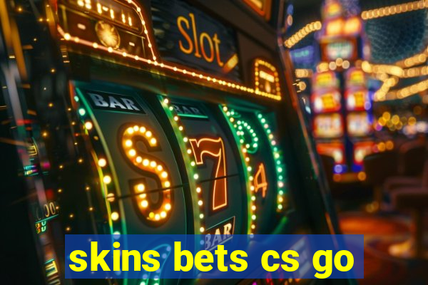 skins bets cs go